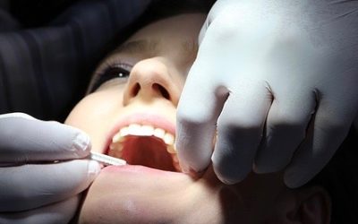 Rêver de dents : quelle signification ?